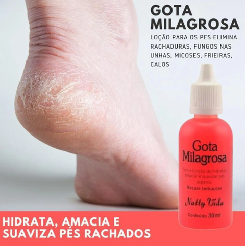 Gota Milagrosa Para Os Pés - Combate Rachaduras